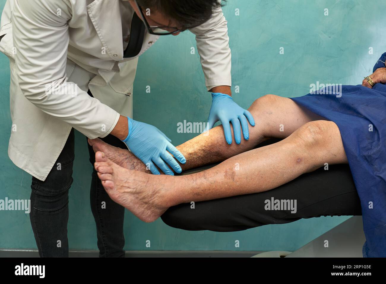 Doctor examining a mature woman with varicose veins Stock Photo