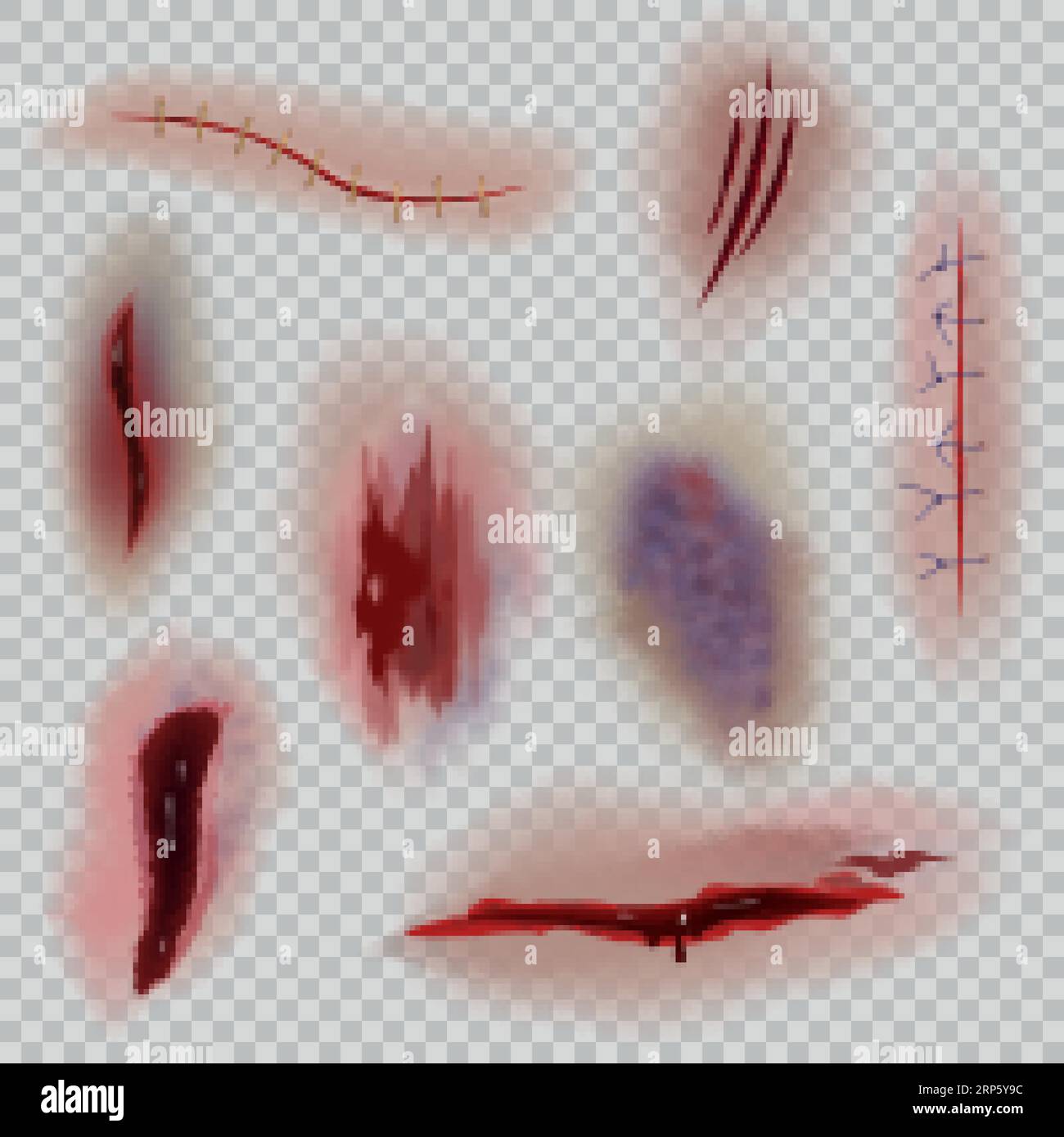 Realistic wounds. Scars, surgical stitches and bruise, skin incision