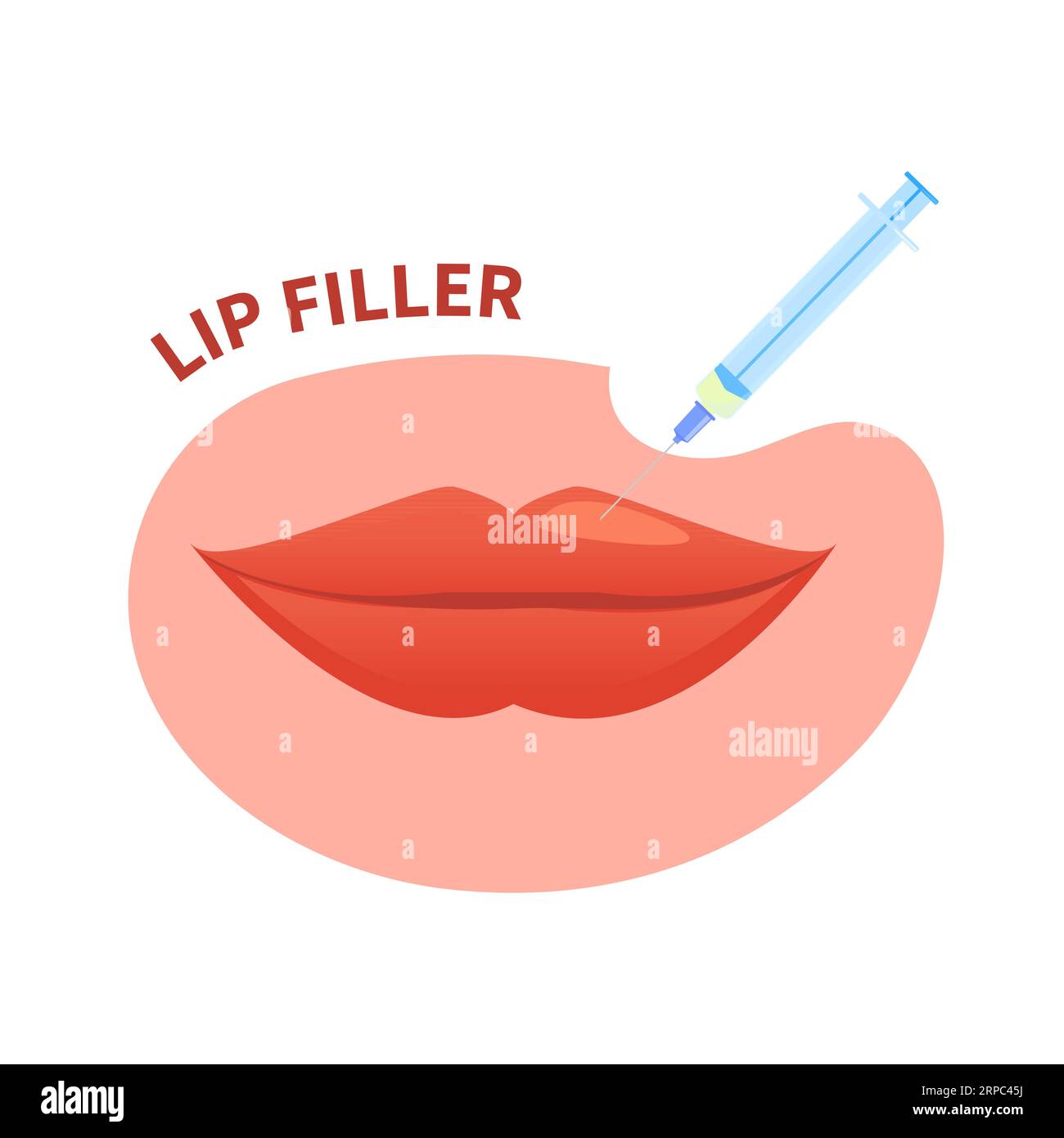 Lip filler plumping augmentation with beauty injection Stock Vector