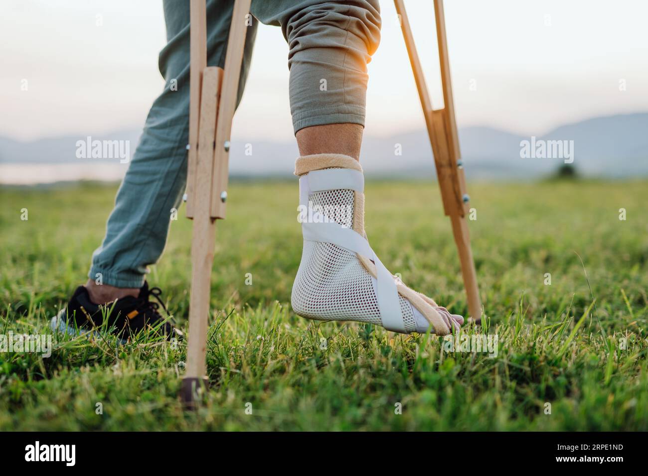 Close up of broken ankle in plaster cast Stock Photo Alamy
