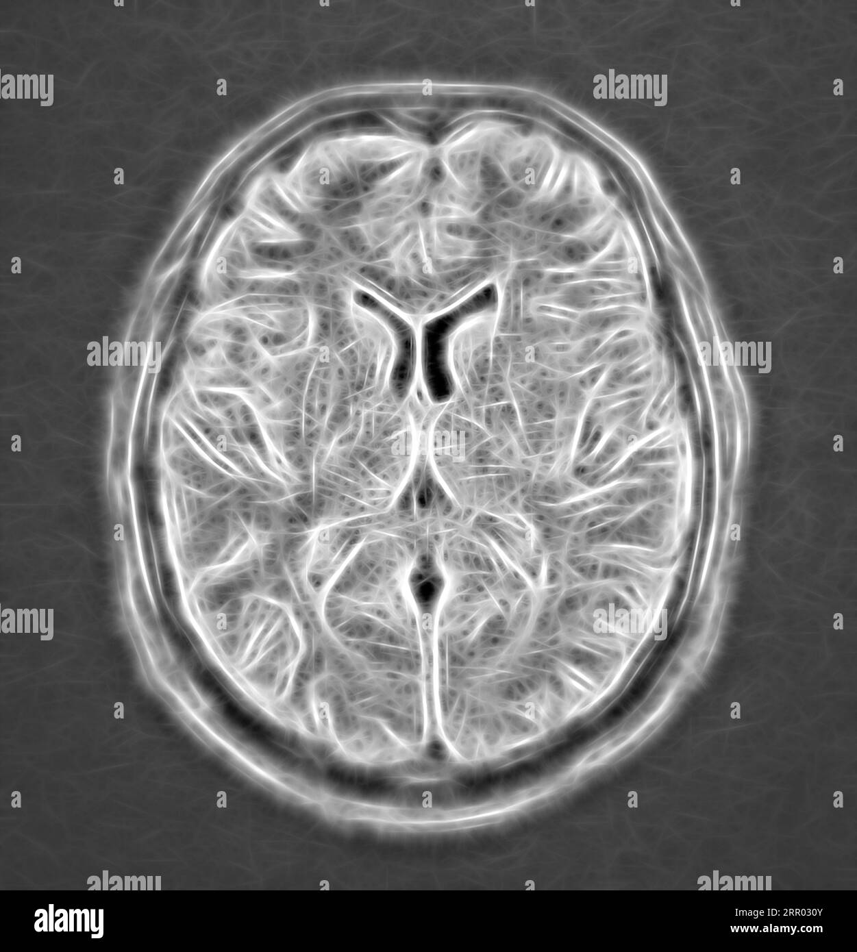 Human brain, MRI scan Stock Photo - Alamy