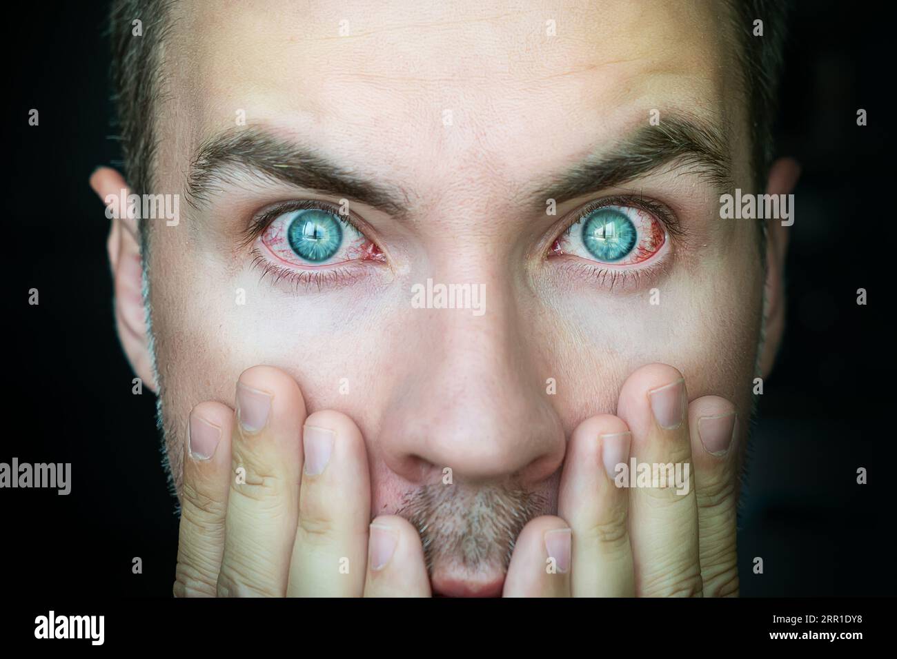 redness of the man's eyes, a surprised look at the camera