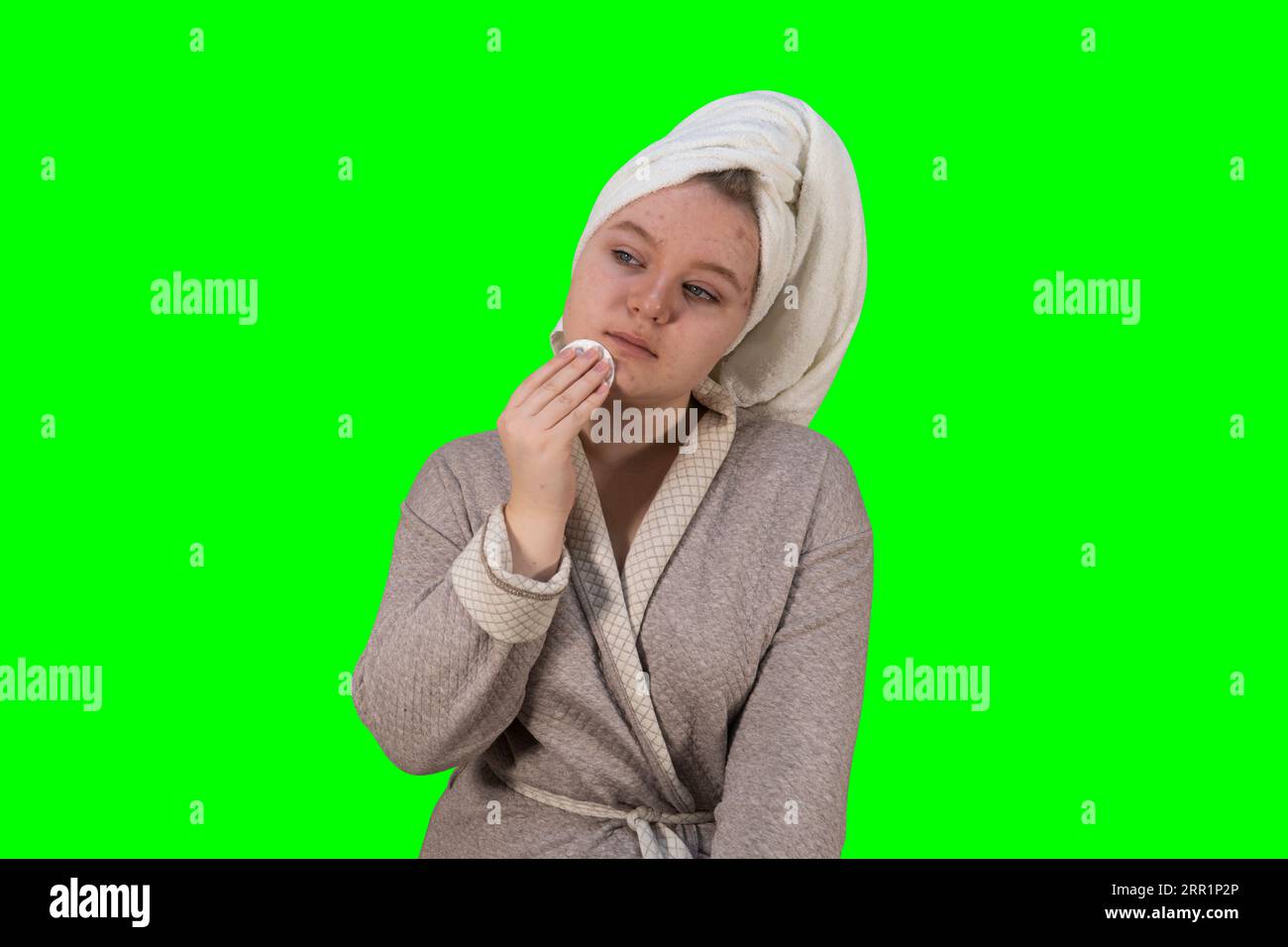 A girl in a dressing gown on a green background (chroma key) smears a rash on her face. Problem skin. Medicine, healthcare and home treatment concept Stock Photo