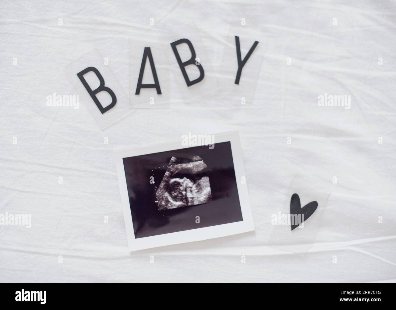X ray fetus white sheets Stock Photo