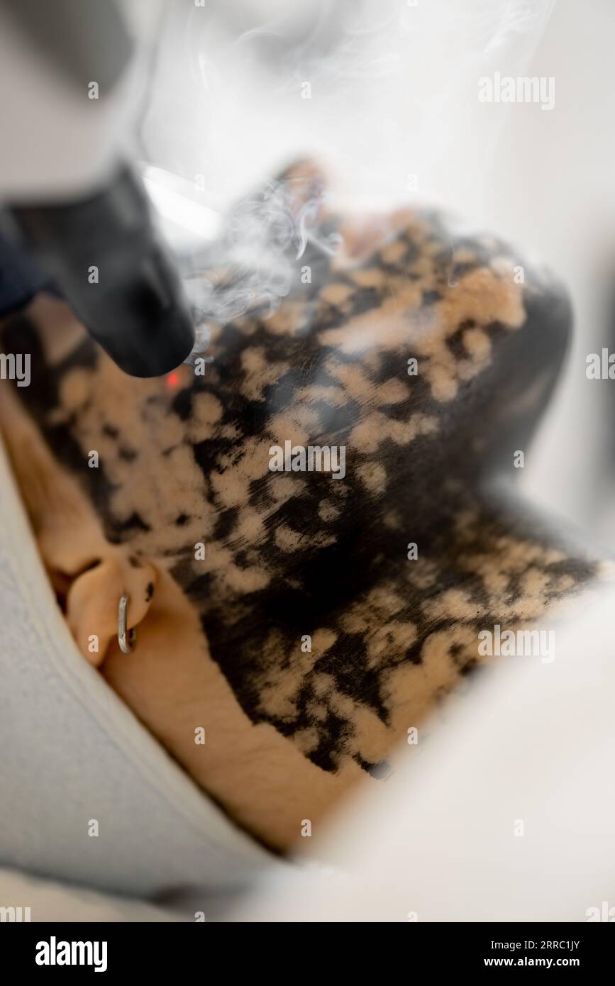 Close up carbon face peeling hi-res stock photography and images - Alamy