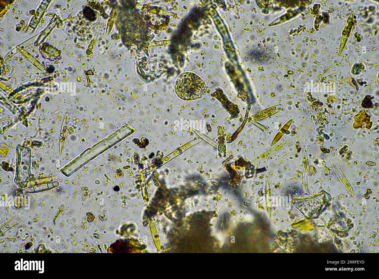 diatom and water under the microscope in australia Stock