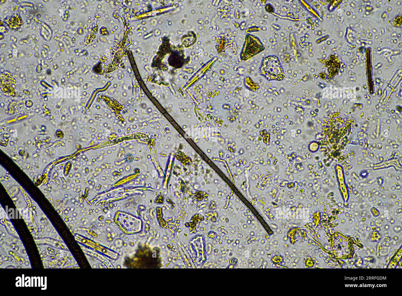 Fungal and fungi hyphae under the microscope in the soil and compost ...