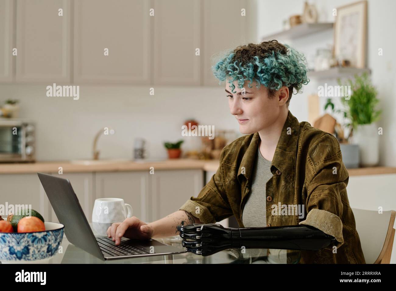 Young woman with prosthetic arm working on laptop while sitting in the kitchen Stock Photo