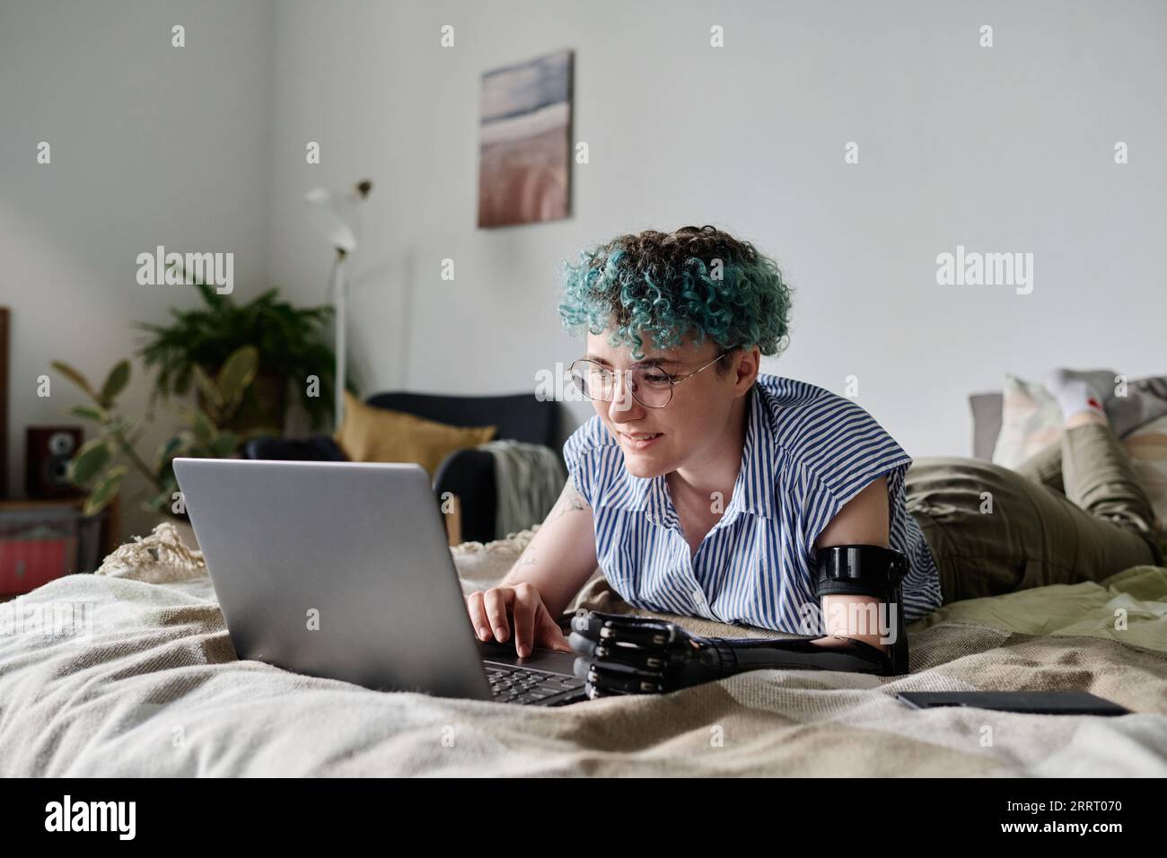 Woman with prosthetic arm using laptop in her free time while she lying on bed in bedroom Stock Photo