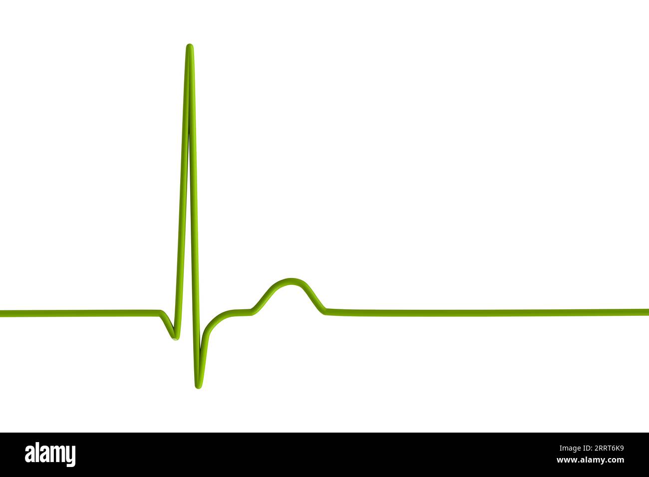 Junctional Rhythm Of The Heartbeat Illustration Stock Photo Alamy rhythm-of-musical-tones-and-rays-of-sunlight-music-tone-sun-png