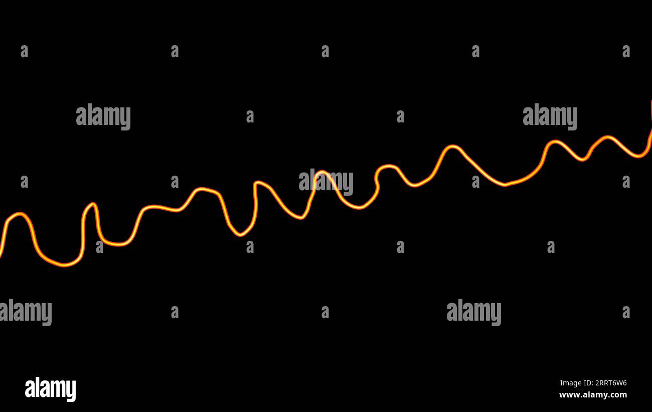 Ventricular fibrillation heartbeat rhythm, illustration Stock Photo - Alamy