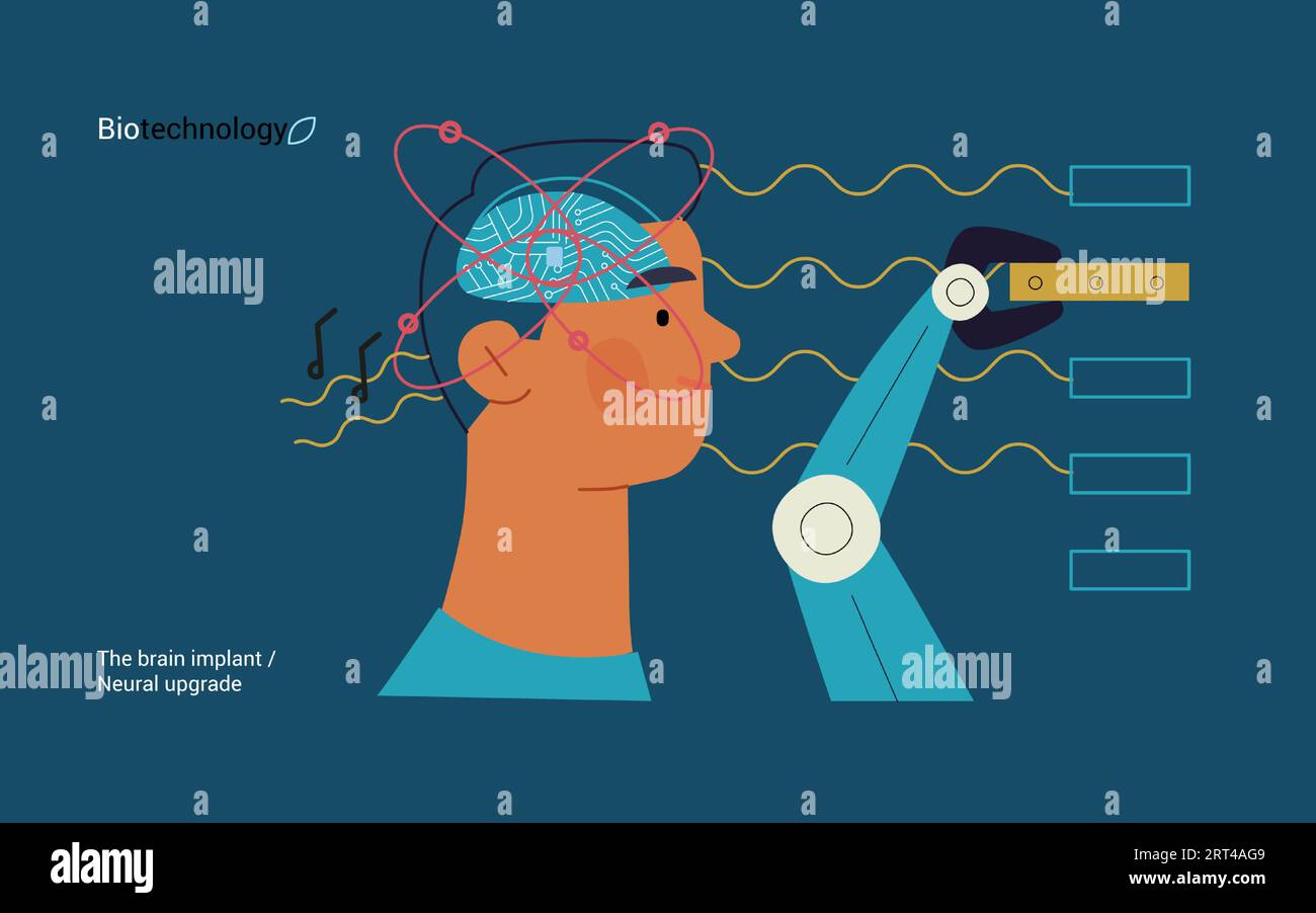 Bio Technology Brain Implant Neural Upgrade Modern Flat Vector   Bio Technology Brain Implant Neural Upgrade Modern Flat Vector Concept Illustration Of Brain Implant Integration Enhanced Cognitive Abilities Pu 2RT4AG9 