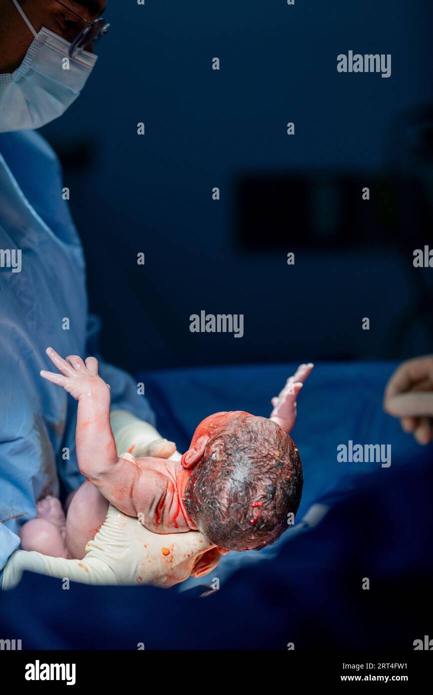 C-section surgery umbilical cord, doctor operating. Stock Photo
