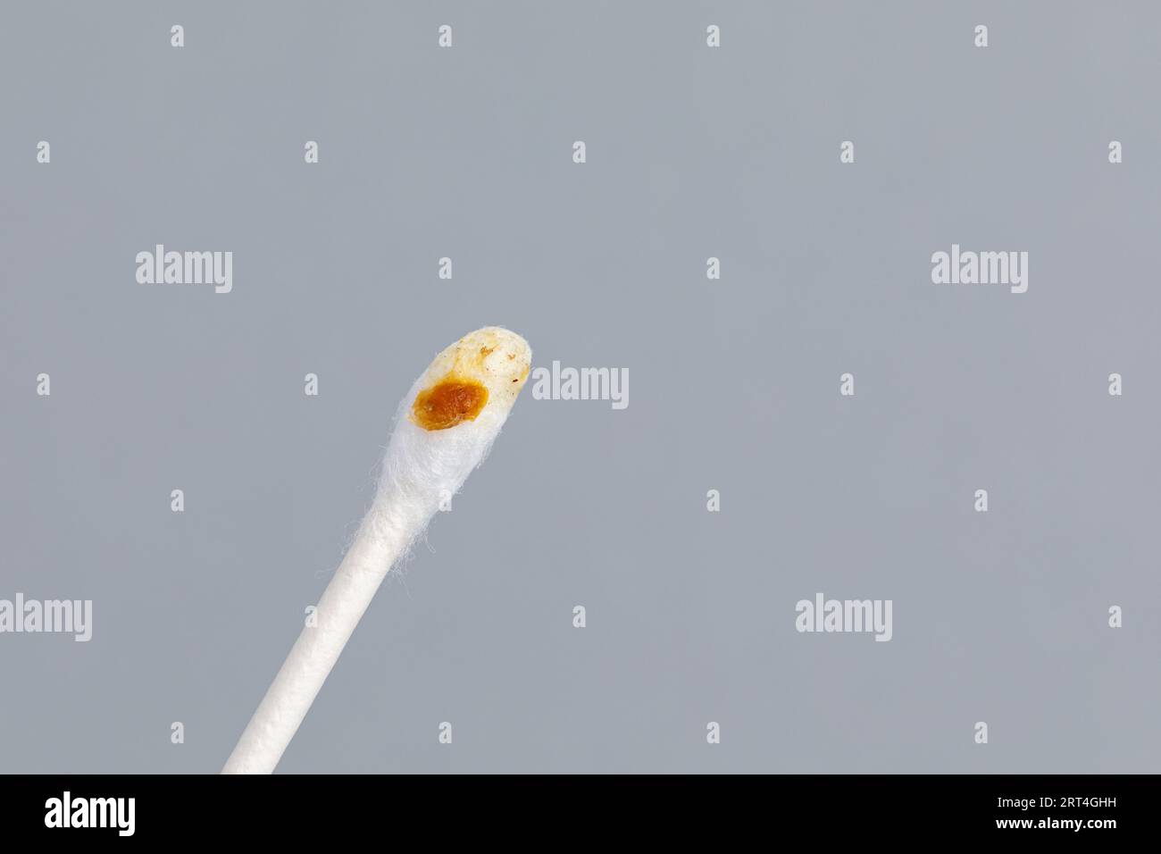 Earwax on cotton swab. Ear health, problems, cleaning and hearing loss concept. Stock Photo