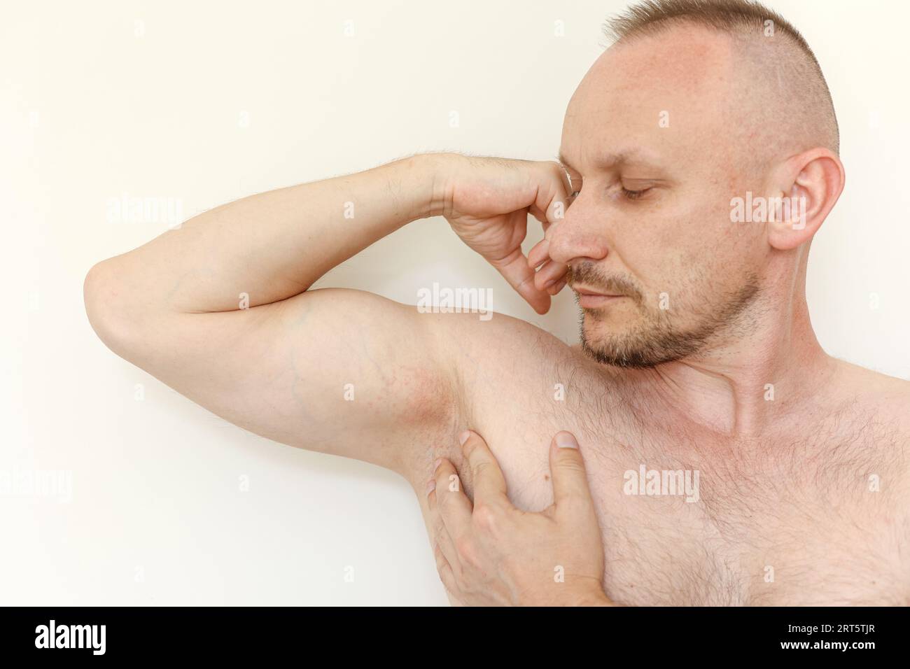 Young man shows irritation on the sensitive skin after using a razor ...