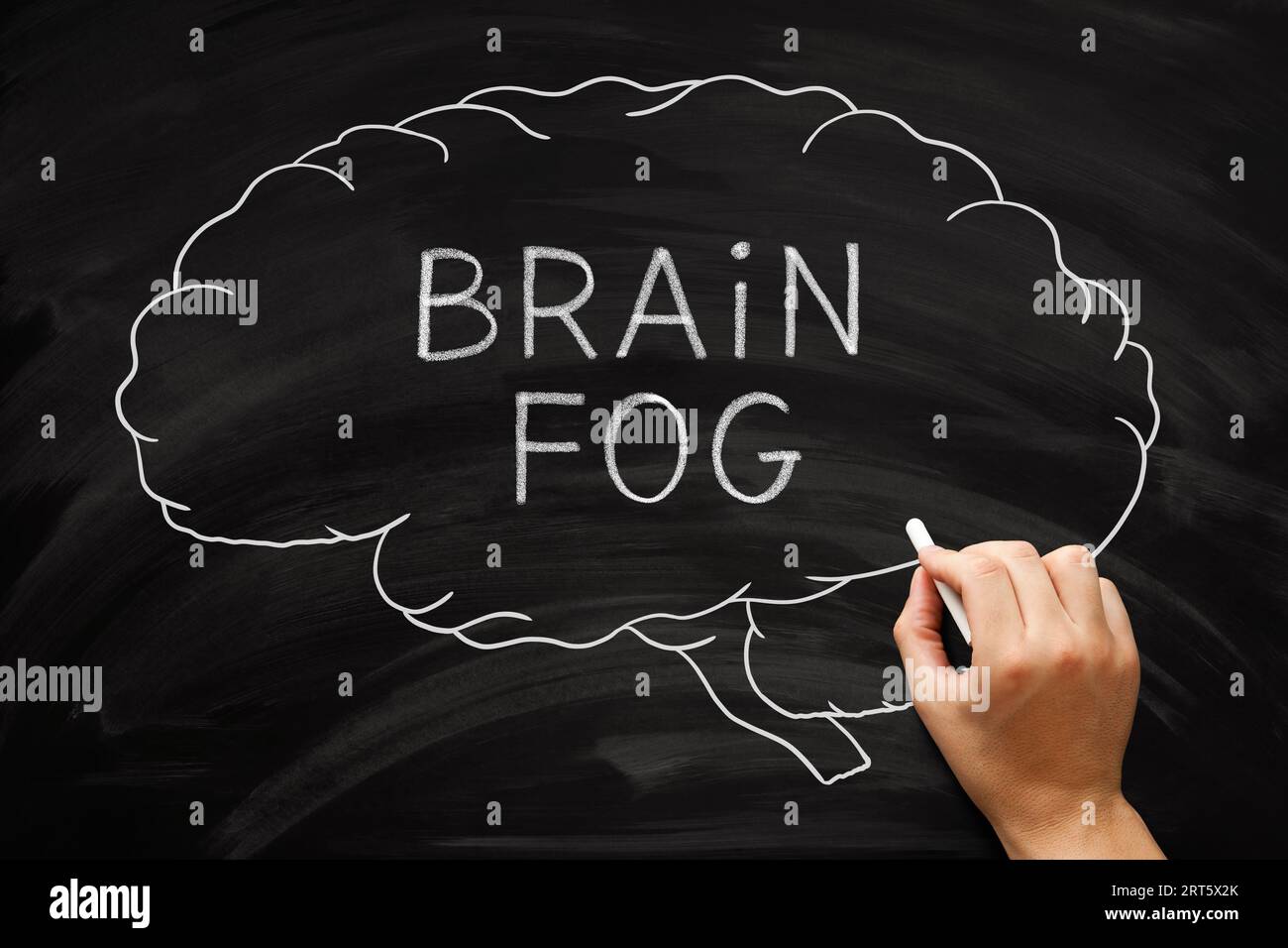 Hand drawing brain fog concept about memory problems, lack of mental clarity and an inability to focus. Stock Photo