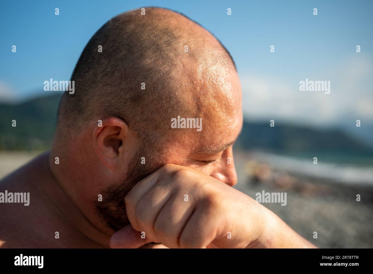 Overweight man rubbing sweat of face, forehead suffering from extra heat weather in summer. Stock Photo
