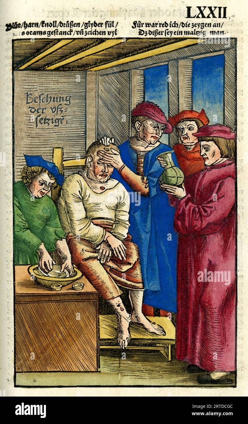 PHYSICIANS WITH A PATIENT from Feldbuch der Wundartzney published in Strasbourg in 1617 by Hans von Gersdorff Stock Photo