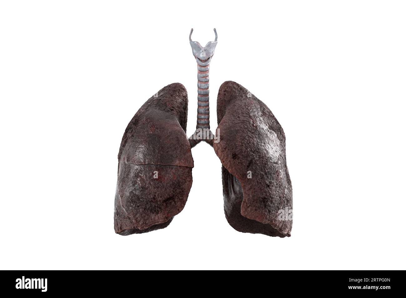 Realistic 3d illustration of sick smoker lungs isolated on white background. Front view of damaged human lungs Stock Photo