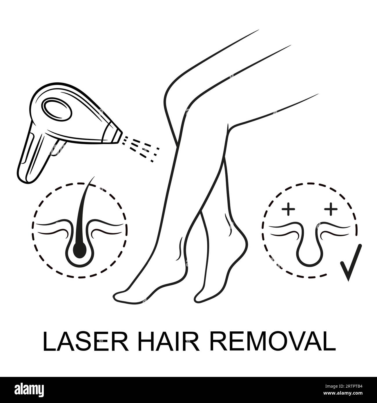 Laser hair removal woman leg skin epilation, IPL light beam epilator device, body depilation procedure line icon. Cosmetology beauty treatment. Vector Stock Vector