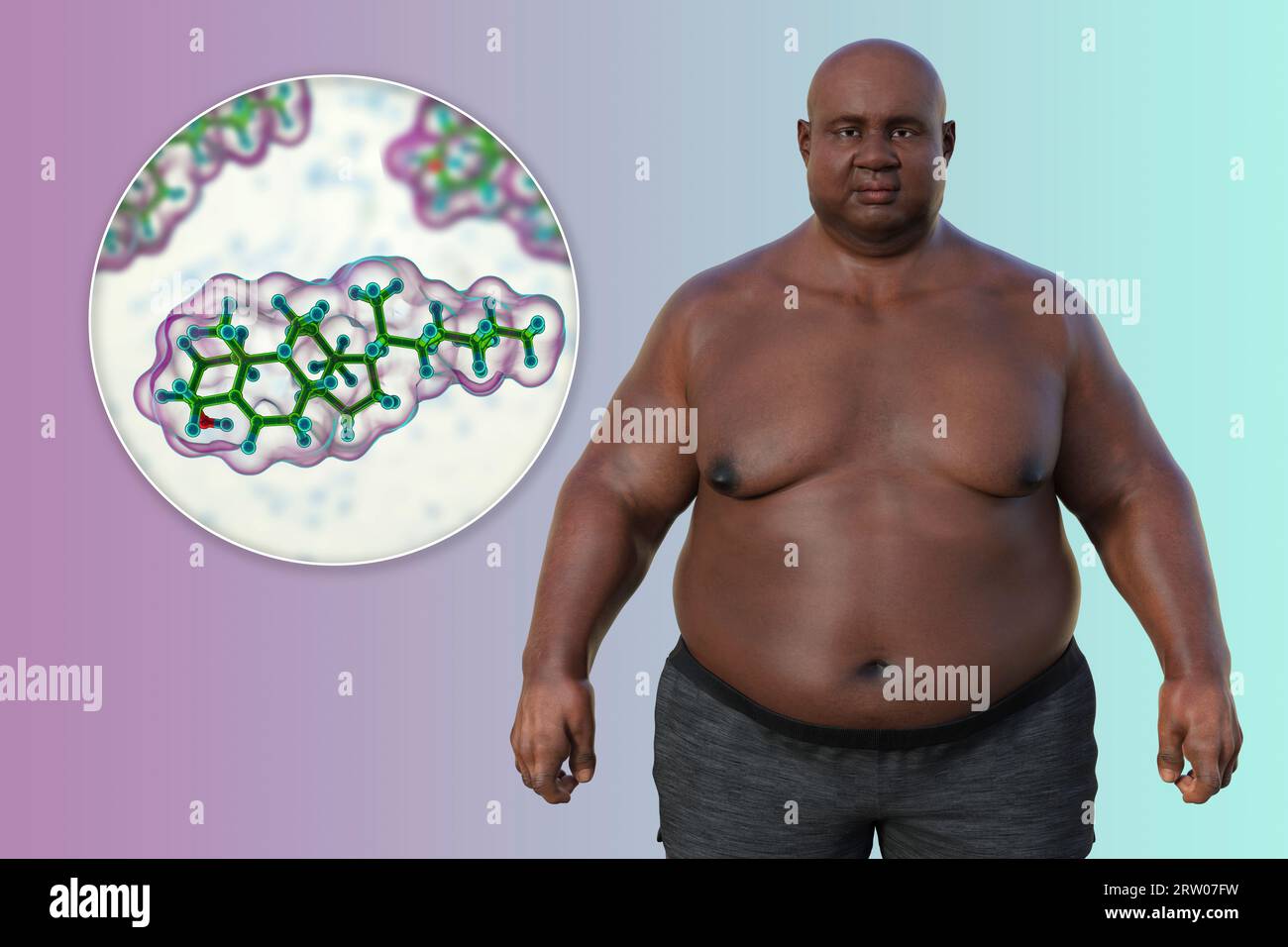 Overweight man and cholesterol molecule, illustration Stock Photo