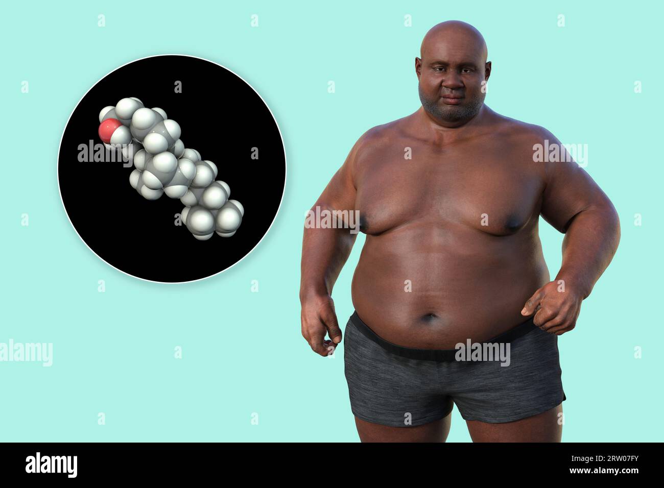 Overweight man and cholesterol molecule, illustration Stock Photo