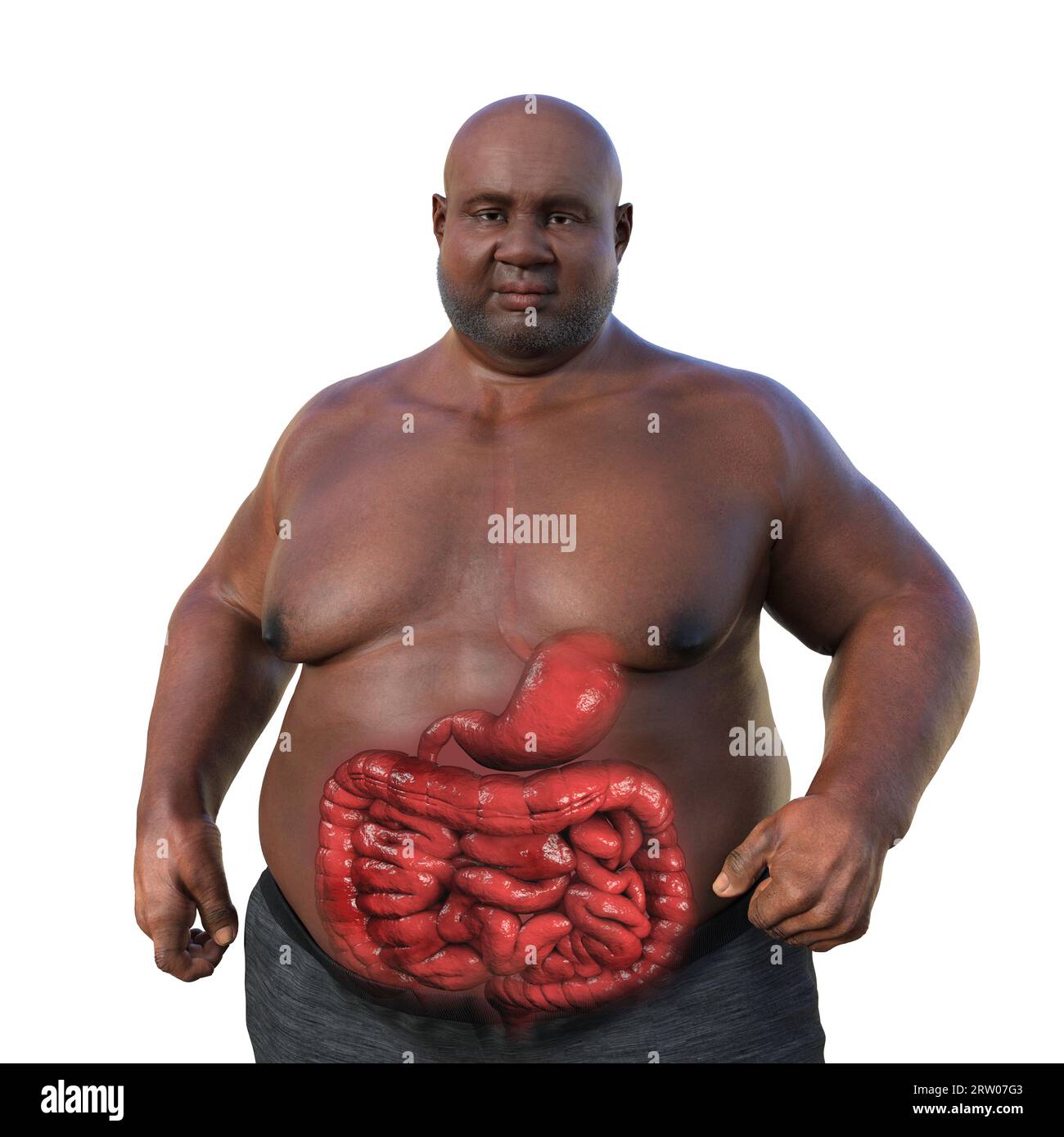 Obese man's digestive system, illustration Stock Photo