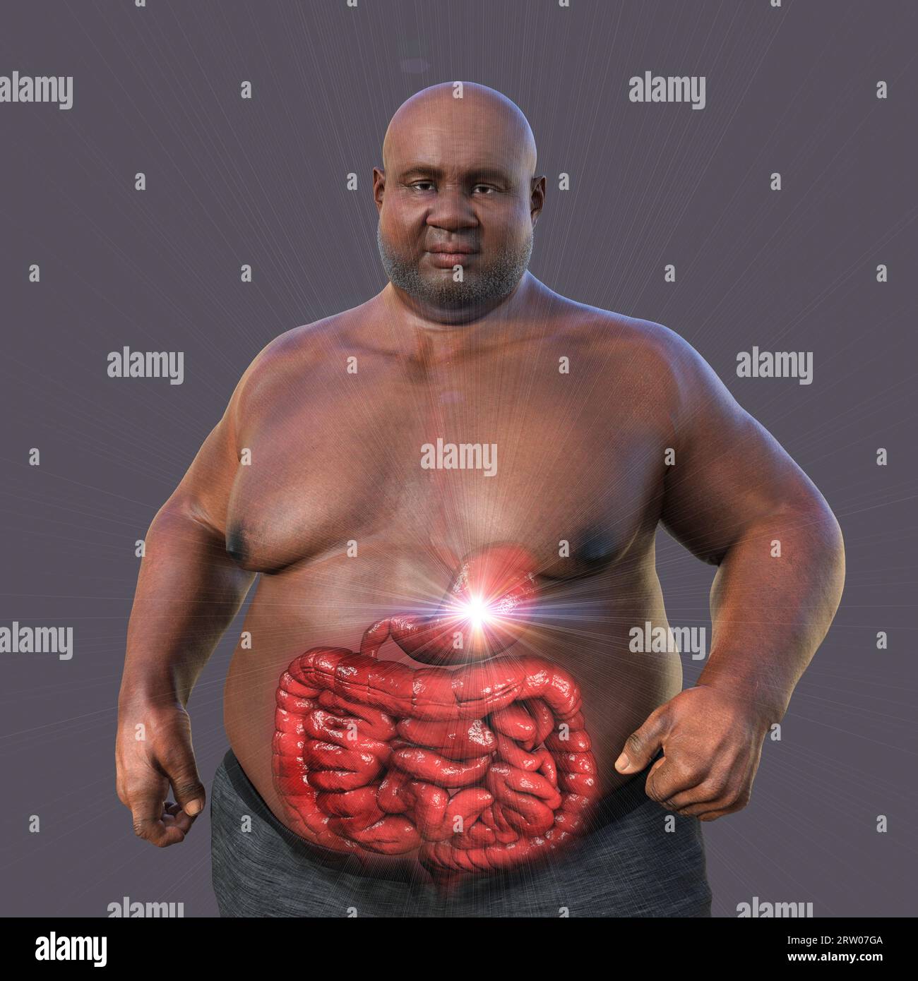 Obese man's digestive system, illustration Stock Photo