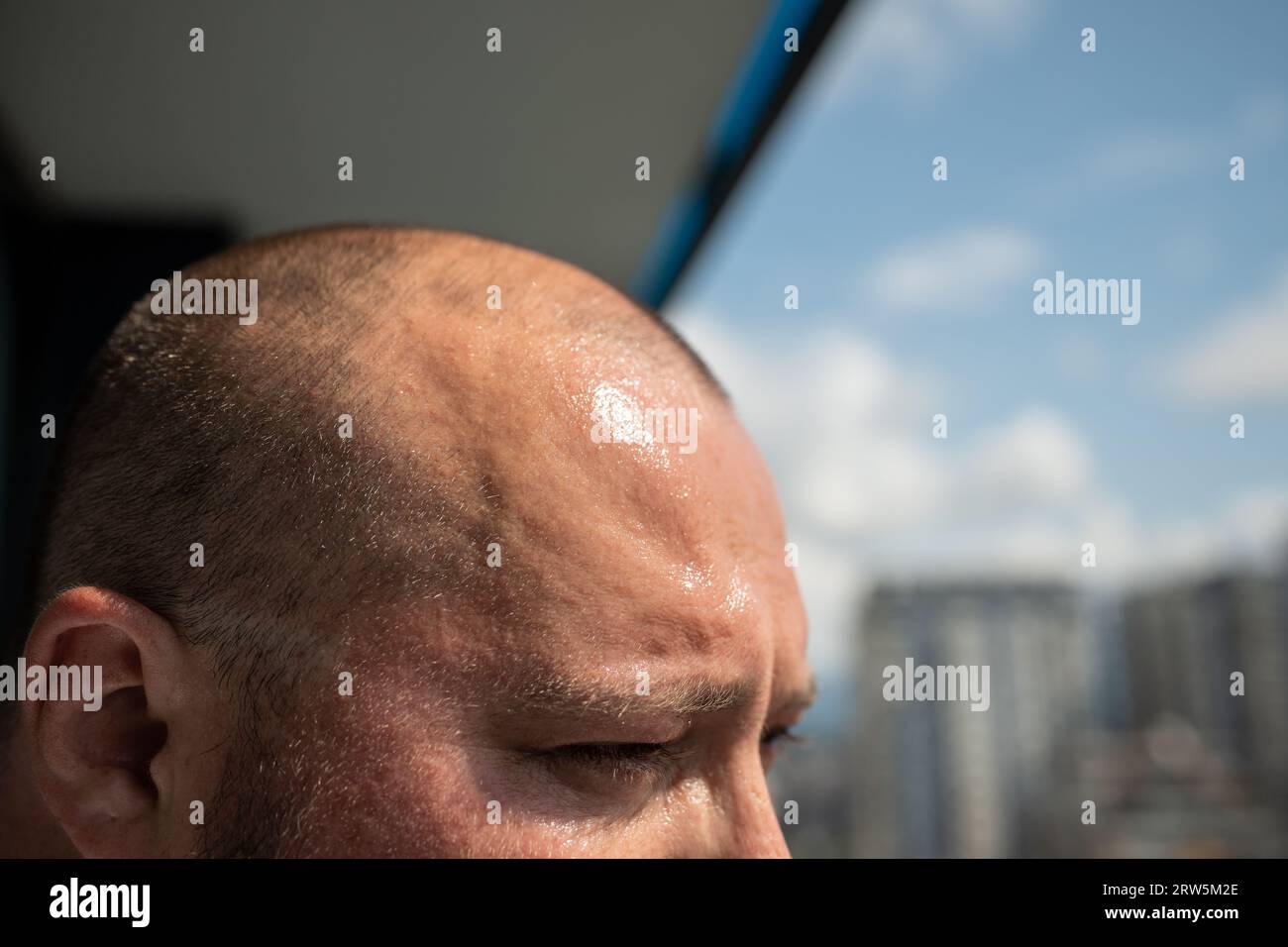 Sweat broke out on forehead of overweight man in hot weather standing in sun. Stock Photo