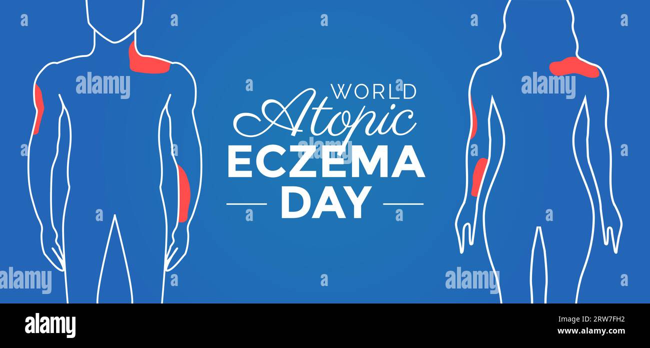 World Atopic Eczema Day Background Illustration Design with People ...