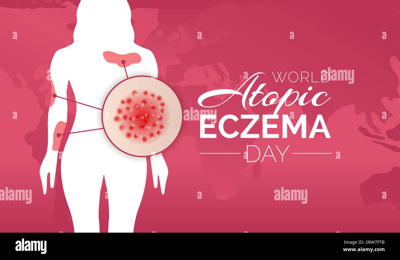 Red World Atopic Eczema Day Background Illustration Design with a Girl ...