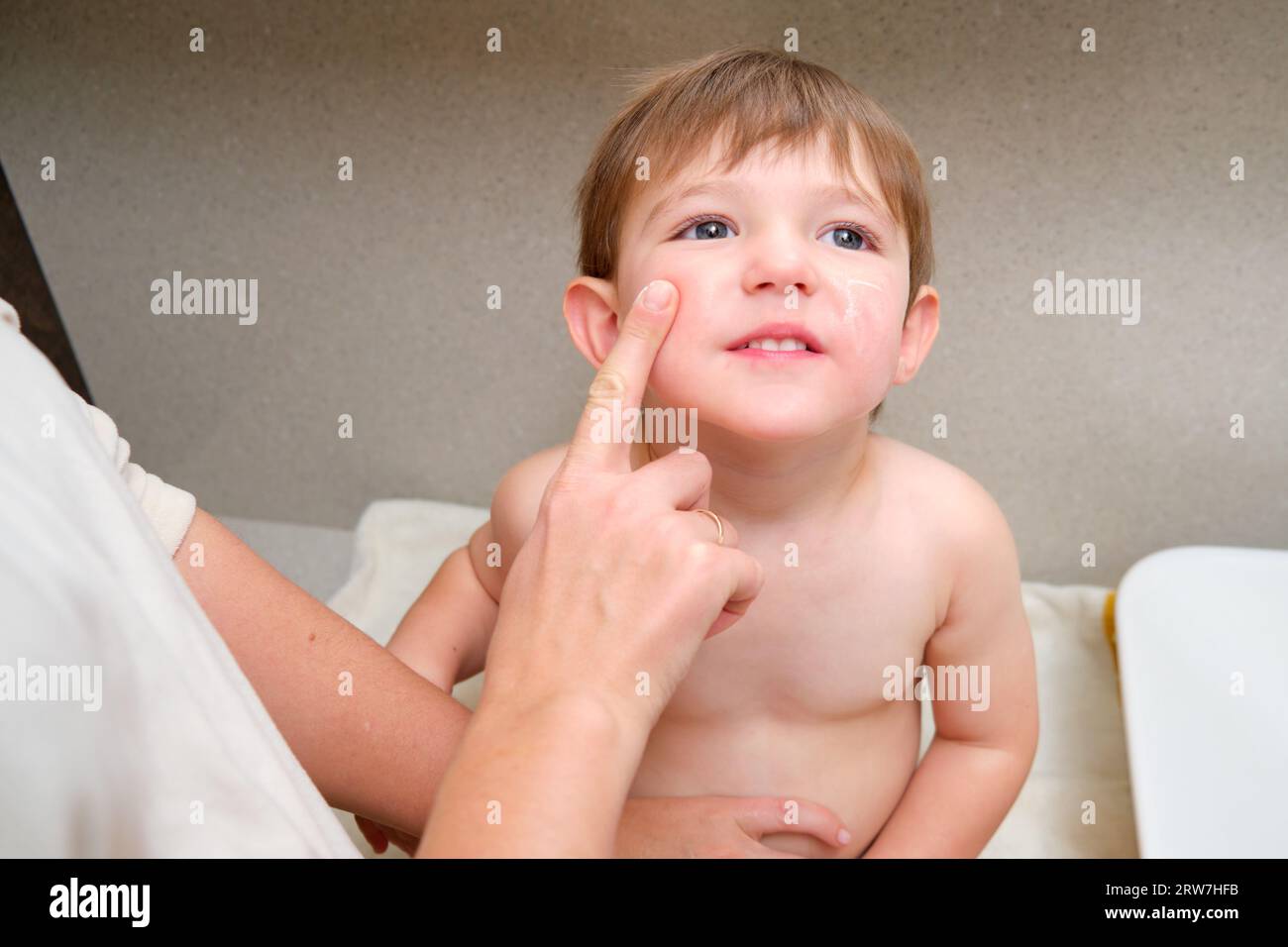 In the bathroom, a mother uses cream to soothe her child eczema on his cheeks. Kid aged two years (two-year-old boy) Stock Photo