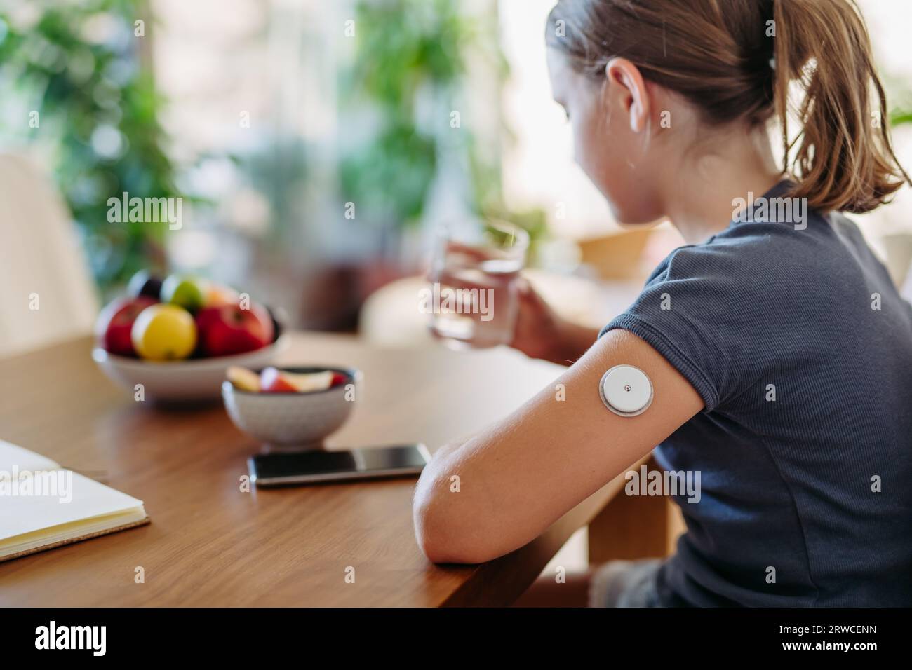 Close up of continuous glucose monitor sensor on girl's arm Stock Photo
