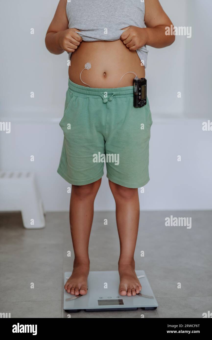 A young boy with diabetes weighing himself on bathroom scale Stock