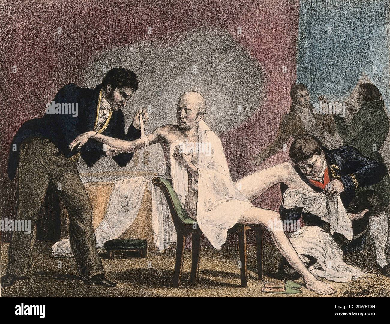 An emaciated old man being treated by four doctors, 1852, a steam bath billows in the background. The two men on the far right hold a glass eye and a pair of false teeth, France, Historic, digitally restored reproduction of an original of the time Stock Photo
