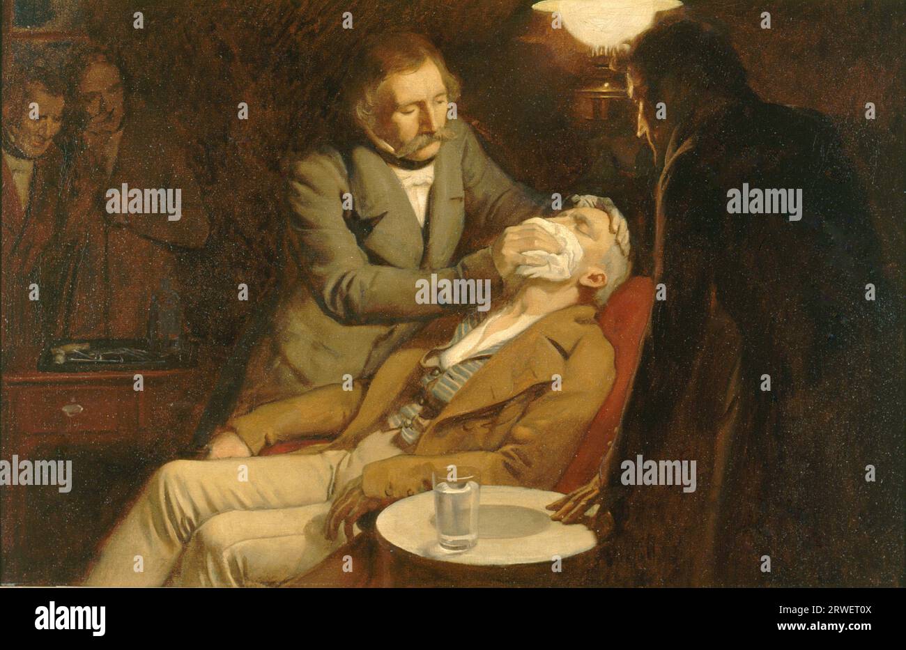 Dentist, the first use of ether for anesthesia in dental surgery, 1846, Historic, digitally restored reproduction of an original of the time. Stock Photo