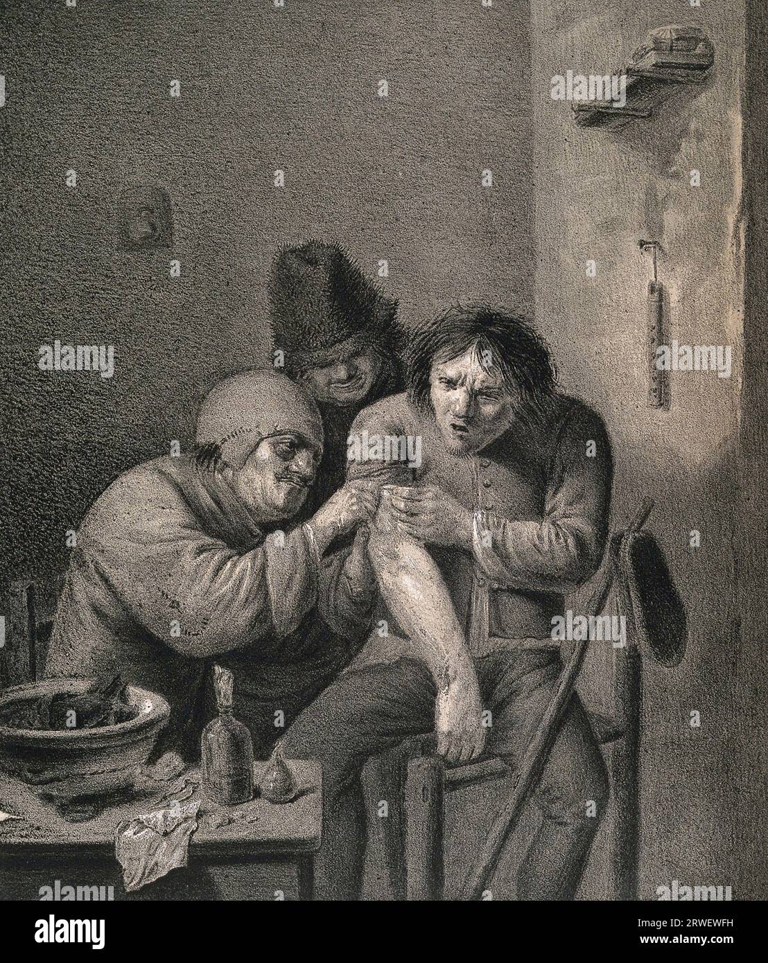 A surgeon dresses the wound of a grimacing patient, Wounds and injuries, treatment in 17th century Netherlands, Historical, digitally restored reproduction from a 19th century original Stock Photo