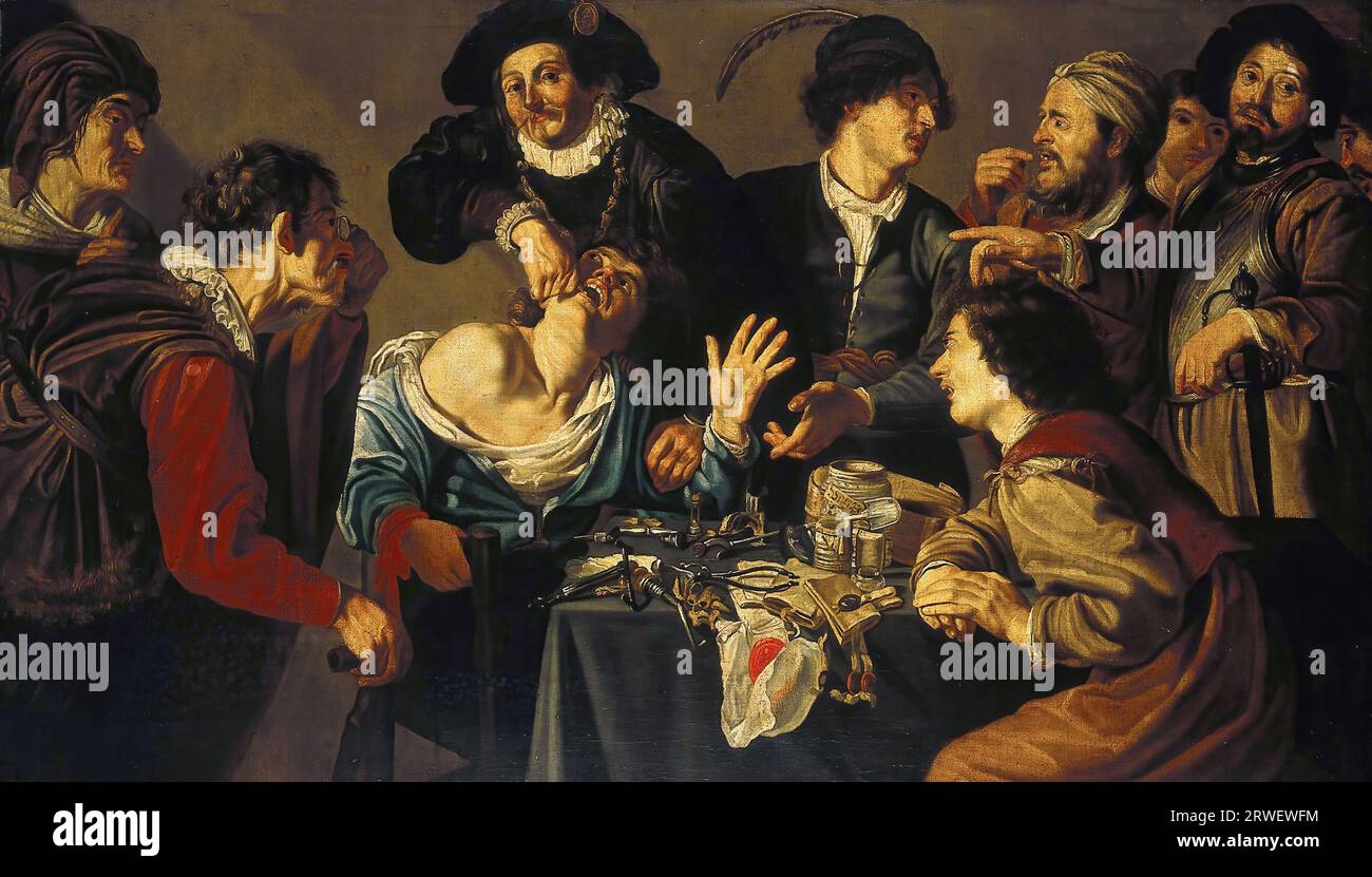 A dentist pulling a tooth, c. 1620, Netherlands, Painting by Theodoor Rombouts, Historic, Digitally restored reproduction from a 19th century original. Stock Photo