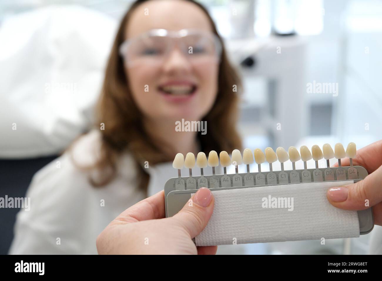 tooth whitening, perfect white crown teeth close up with shade guide