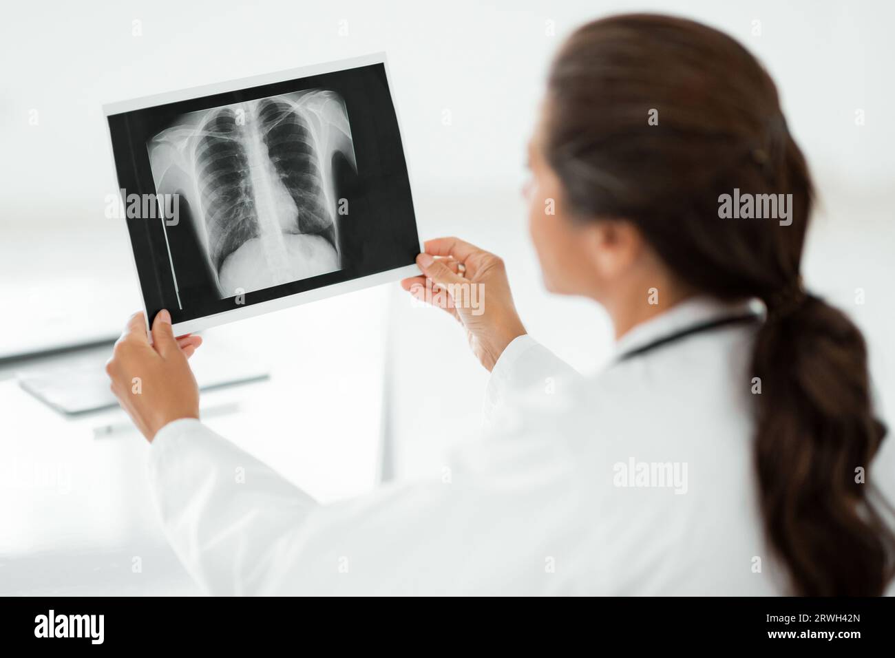 Woman doctor hands holding patient chest x-ray film Stock Photo - Alamy