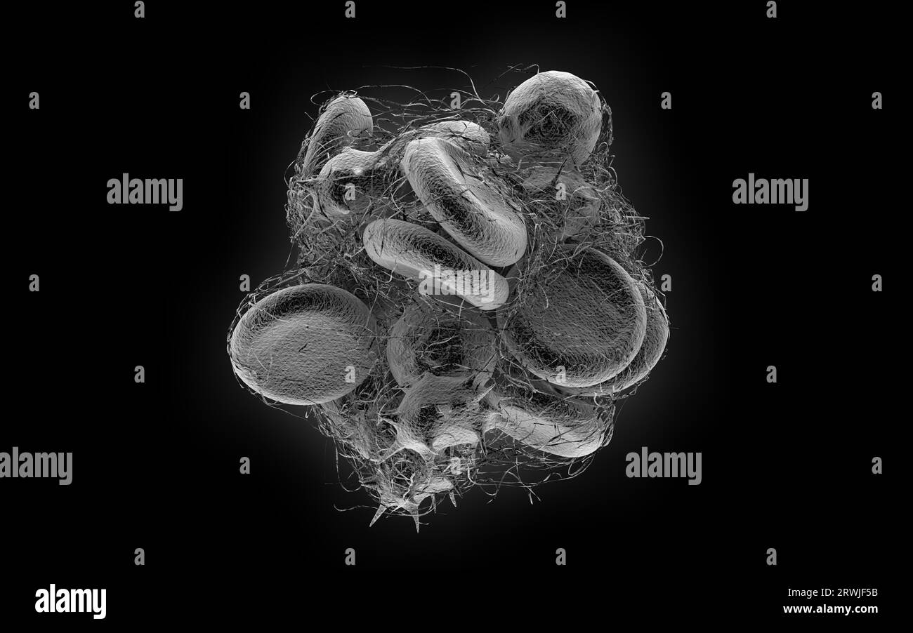 Blood Clot Illustration Stock Photo Alamy Blood Clot Illustration Stock Photo Alamy