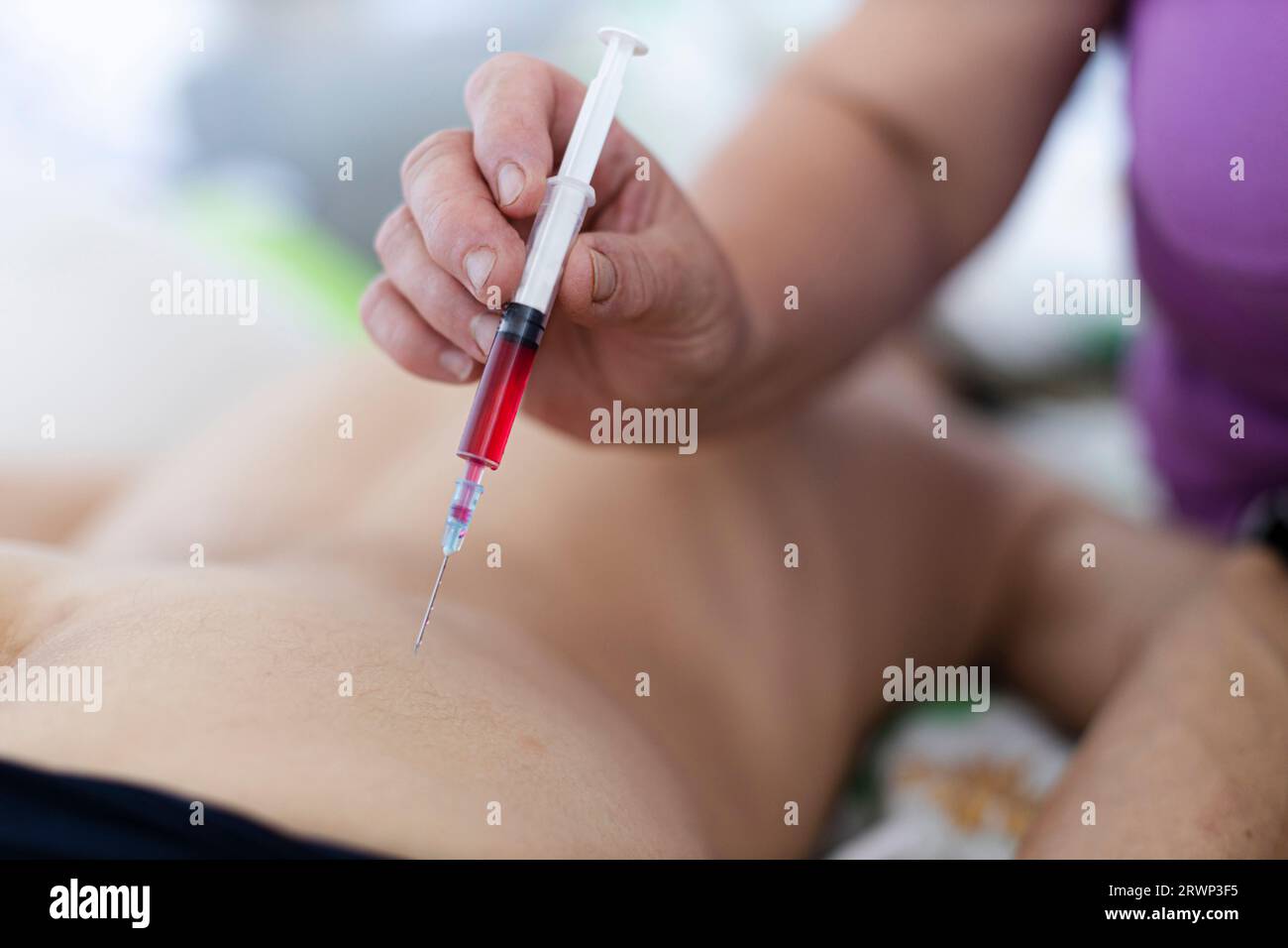 Vitamin b injection hi-res stock photography and images