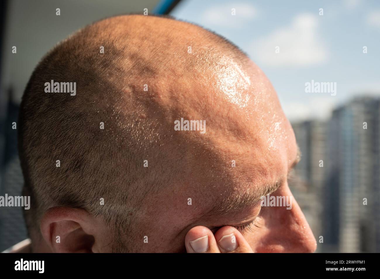 Haggard overheated man with sweating forehead from heat of sun feeling head hurt, dizziness, nausea Stock Photo