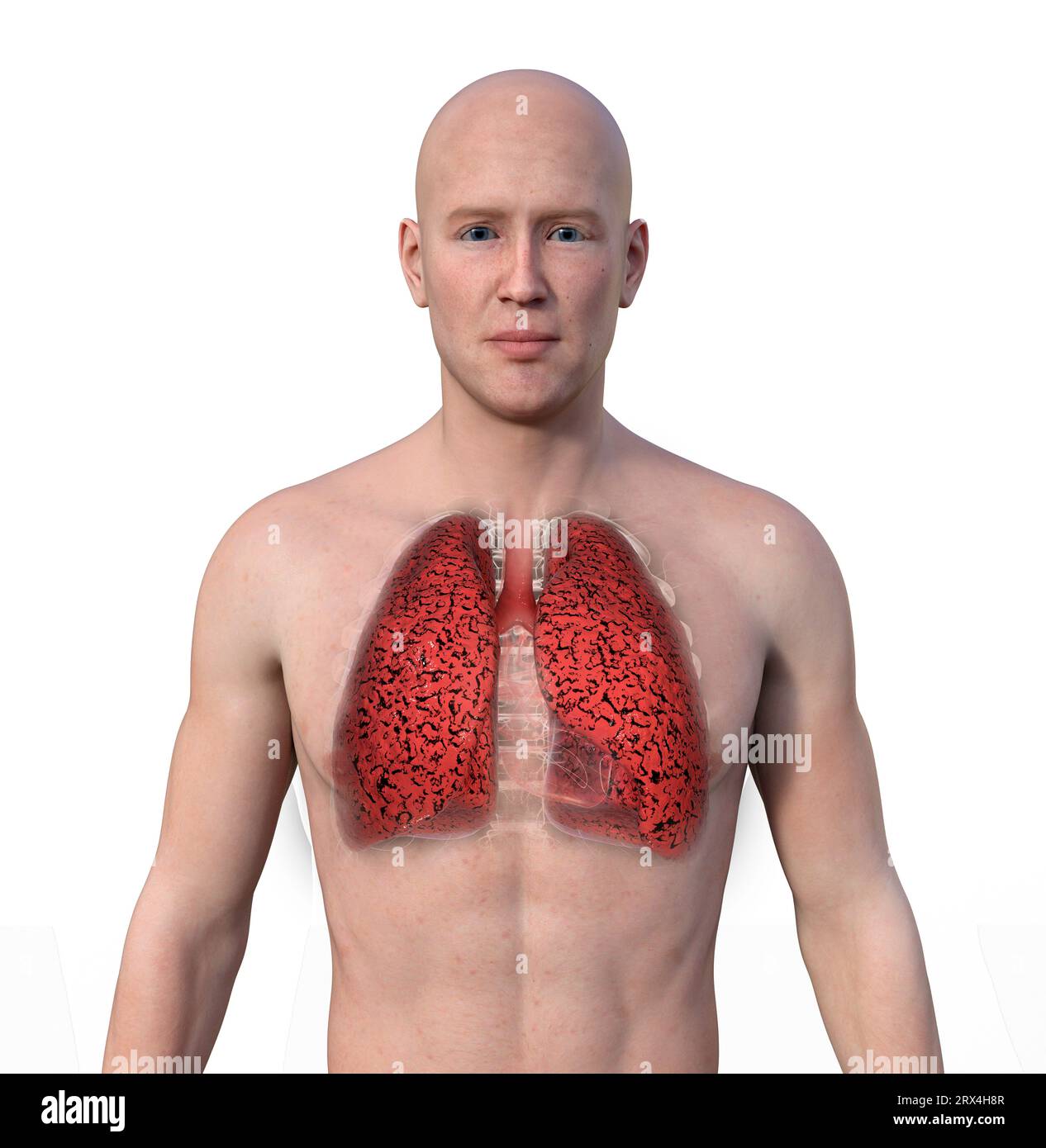 Smoker's lungs, illustration Stock Photo