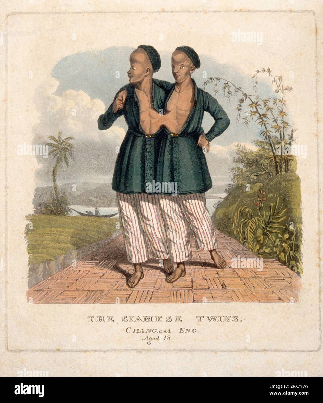 Chang and Eng the Siamese Twins, 1811 – 1874, aged 18 in an oriental landscape, coloured aquatint Stock Photo