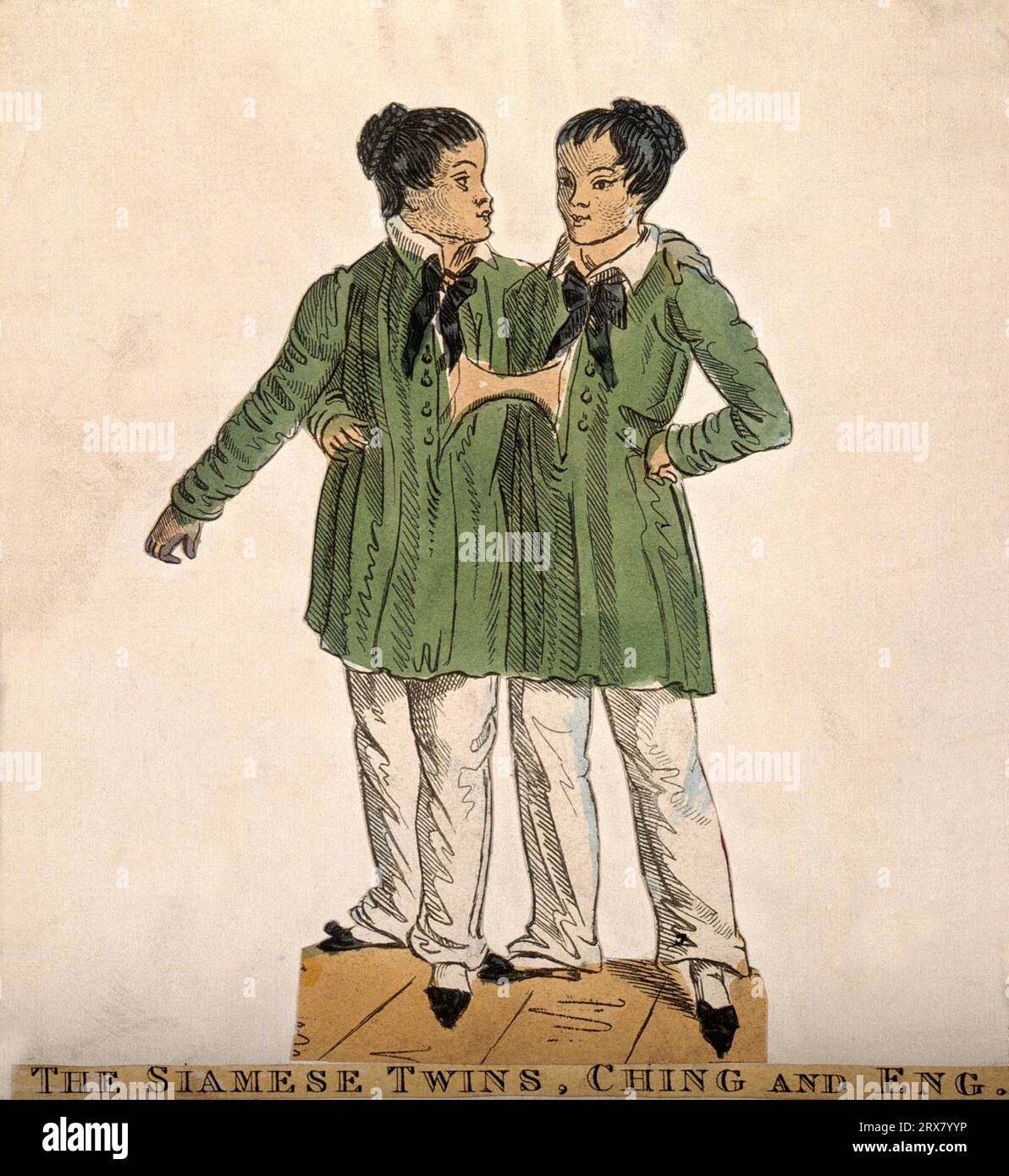 Chang and Eng the Siamese Twins, 1811 – 1874, coloured etching Stock Photo