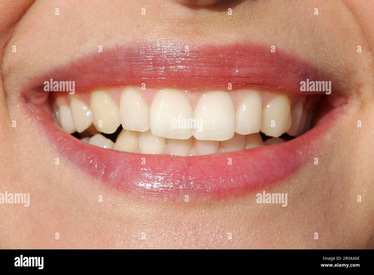 Smile with teeth woman hi-res stock photography and images - Alamy