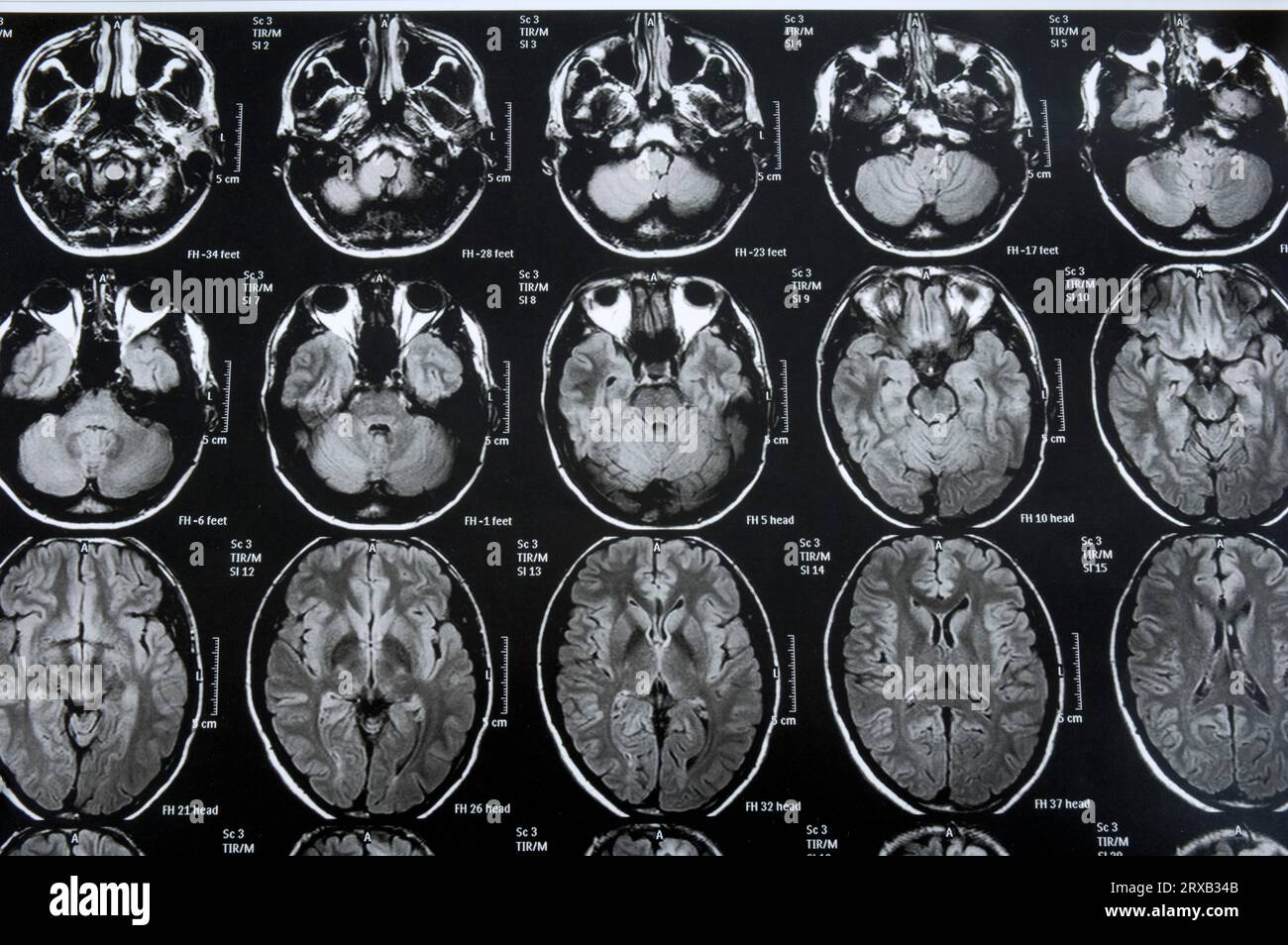 resonance image of human head, xray, xray image, xray