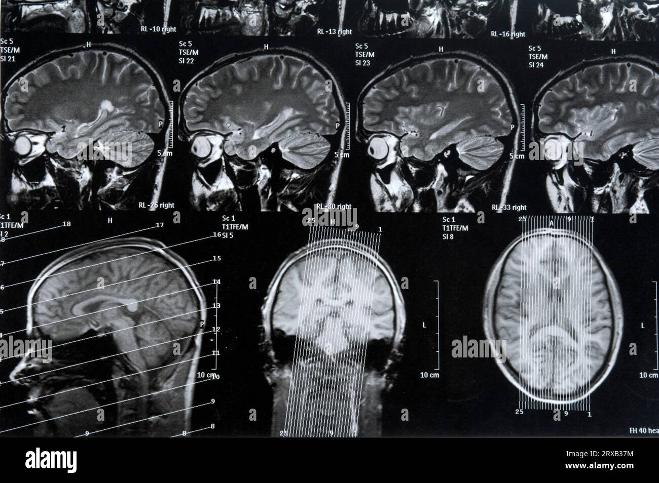 What Does Head X Ray Show at Edwin Frost blog