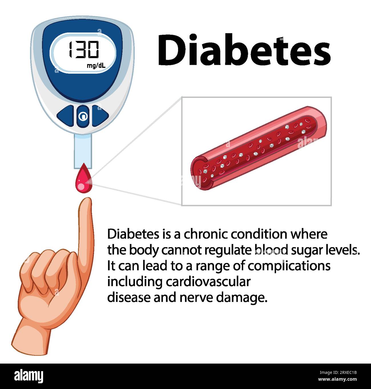 Illustration of a glucose meter device used for checking diabetes Stock ...
